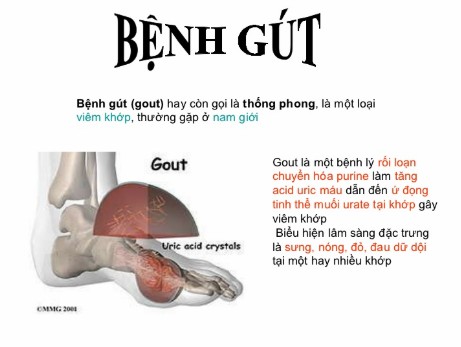 khai-niem-benh-gout